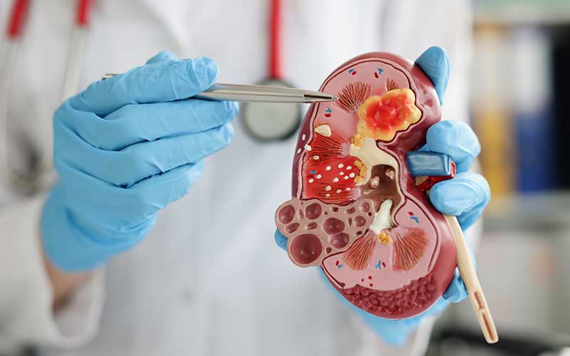 Model of kidney